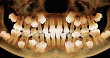 Na téma dentálních digitálních technologií