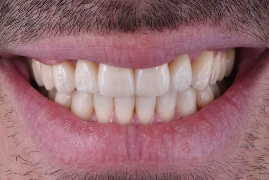 Obr. 16b: Závěrečná extraorální fotografie.