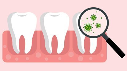 Eisenmangelanämie: Therapie findet Anwendung in Zahnmedizin Eisenmangelanämie: Therapie findet Anwendung in Zahnmedizin