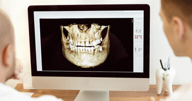 Ohne Strahlenbelastung: Kieferorthopädische Behandlungsplanung