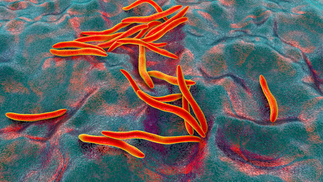 Study links oral bacterium to breast cancer initiation and progression