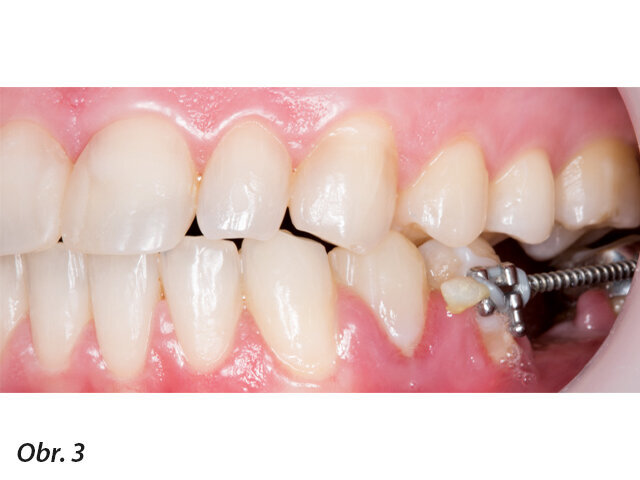 Počáteční klinická situace