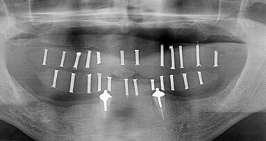 CBCT applications in dental practice: A literature review