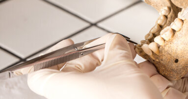 Tooth analysis reveals secrets of our earliest ancestors