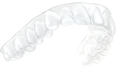 SureSmile® Aligner