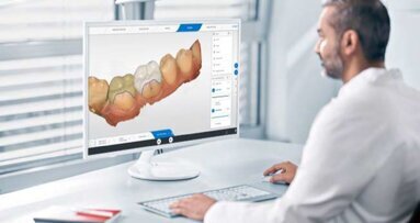 L’aggiornamento del software CEREC 5.3 aumenta la flessibilità del flusso di lavoro ed espande la capacità di produzione con l’integrazione di DS Core