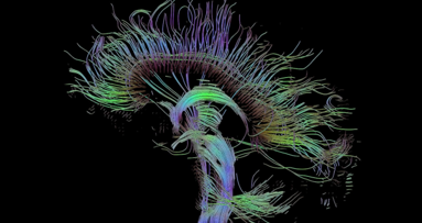 Stamcellen uit tanden kunnen veranderen in hersencellen