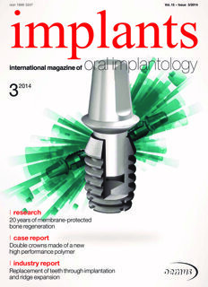 implants international No. 3, 2014 implants international No. 3, 2014