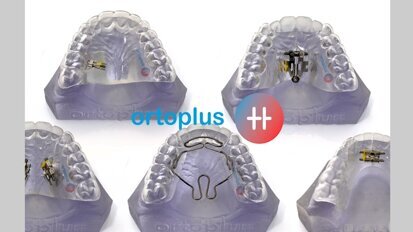 Una técnica que reduce el tiempo de tratamiento de la ortodoncia invisible