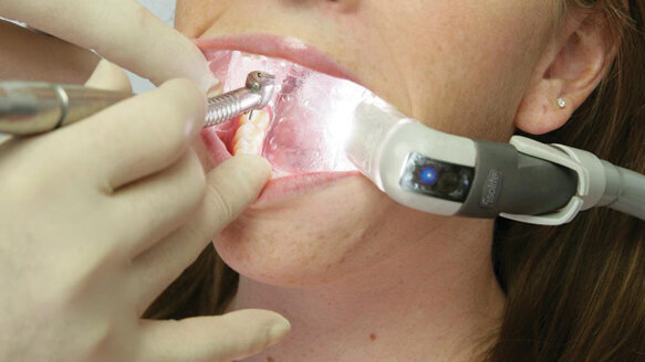 Isolite dryfield illuminator