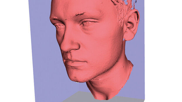 Cefalometria Radiation Free possibile e auspicabile alternativa diagnostica?