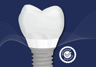 TBR – Implant Tissue Level Z1