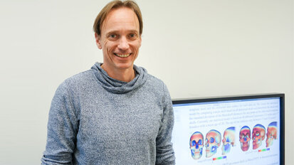 Schädelform in 3D berechnen – spart Röntgenaufnahmen Schädelform in 3D berechnen – spart Röntgenaufnahmen