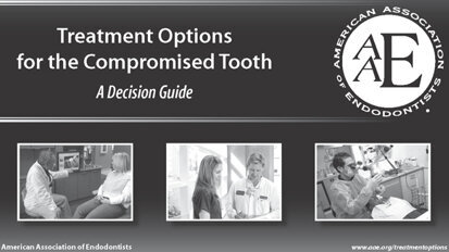 Endodontics before extraction: AAE resource illustrates treatments that save the natural tooth