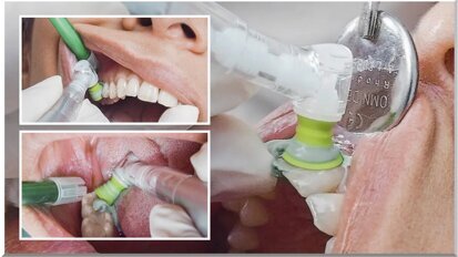 La clave para la rentabilidad de la consulta La clave para la rentabilidad de la consulta