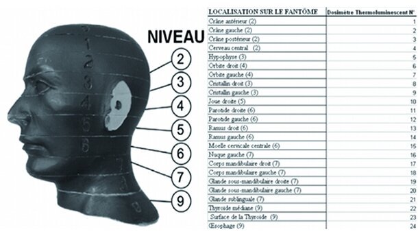 Cone beam pratique en odontostomatologie – Partie II - Principe, technique, qualité d’image, artéfacts, types d’appareil, indications