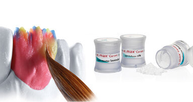 Úžasně realistický IPS e.max Ceram Selection: nové prášky Enamel a Effect