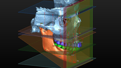 Comunicazione ortodontica per immagini del terzo millennio: dal 2D al 3D