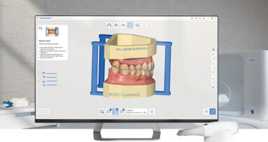 Use Medit Model Builder to create models from digital data