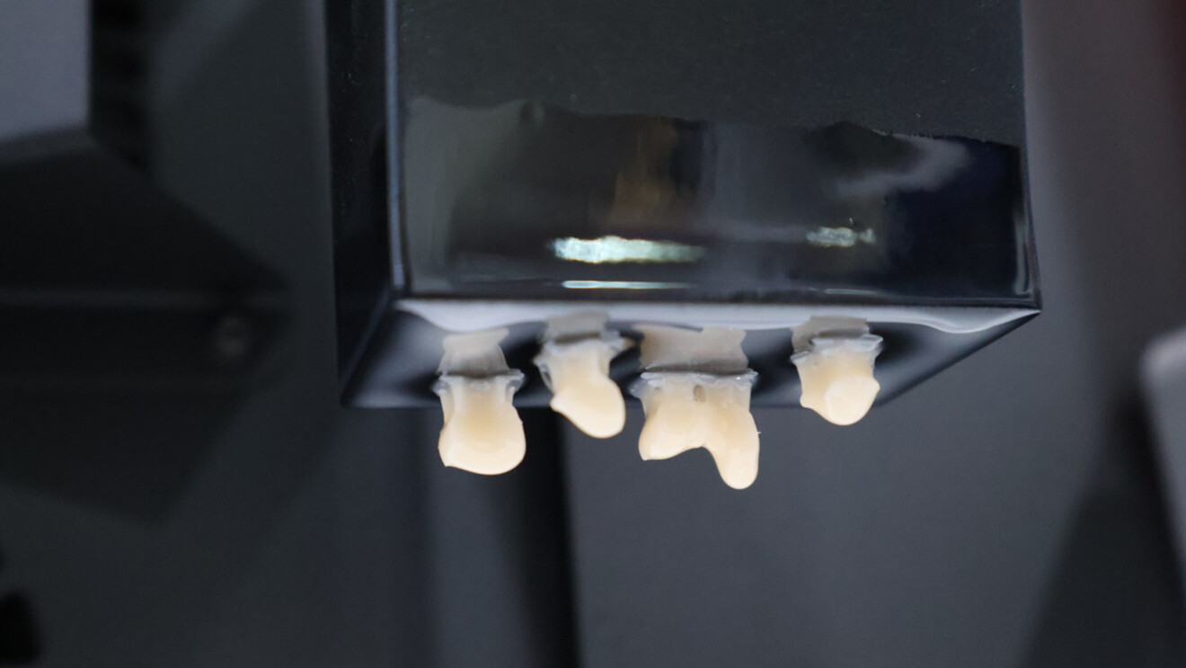 Fig. 4: Freshly printed restorations.