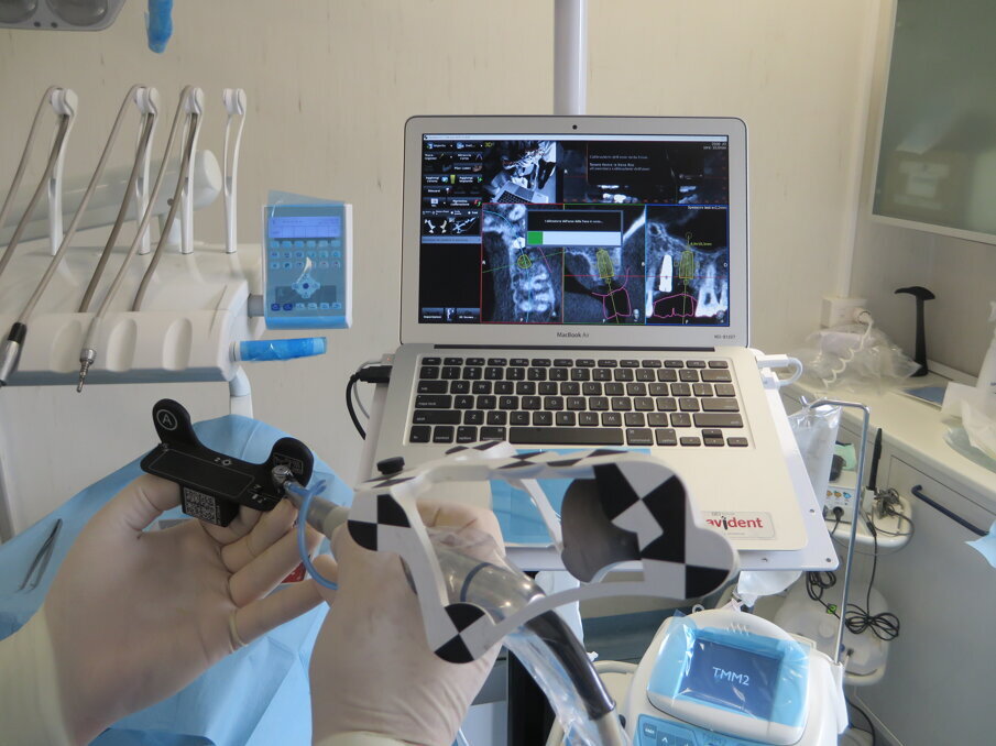 Figg. 10a-10f - Il Drill Tag peculiarità del Navident (a). Questo dispositivo consente di guidare qualsiasi strumento chirurgico. Non potendo essere note a priori le caratteristiche geometriche tridimensionali dello strumento lavorante è necessaria una calibrazione preliminare al gesto chirurgico (b-d). Esempio di navigazione di un Magnetic Mallet (e). Supporto software che consente l’identificazione delle diverse possibili tipologie di strumenti chirurgici guidati (f, g).