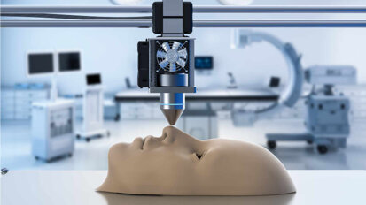 Individuelle Gesichtsimplantate mithilfe von KI Individuelle Gesichtsimplantate mithilfe von KI