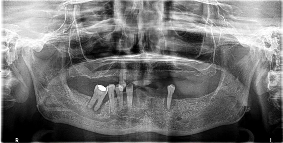 Fig. 2_OPT caso iniziale.