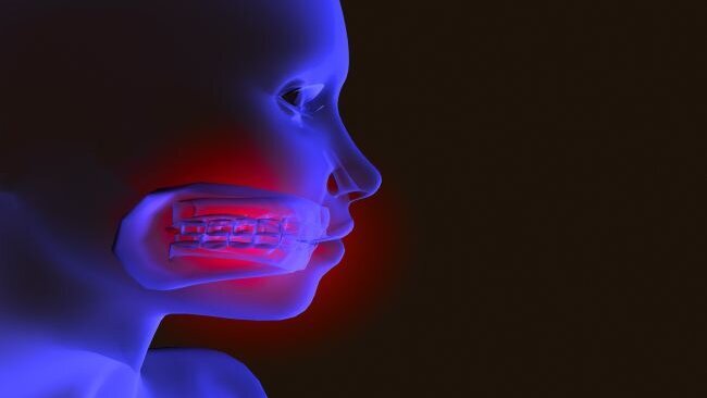 Opleiding kaakchirurgie fors duurder