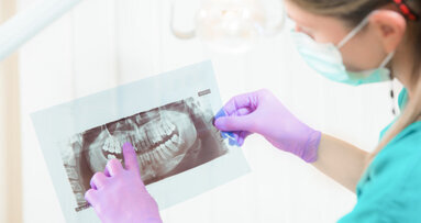 Studie: Skepsis gegenüber Krebsgefahr beim Röntgen