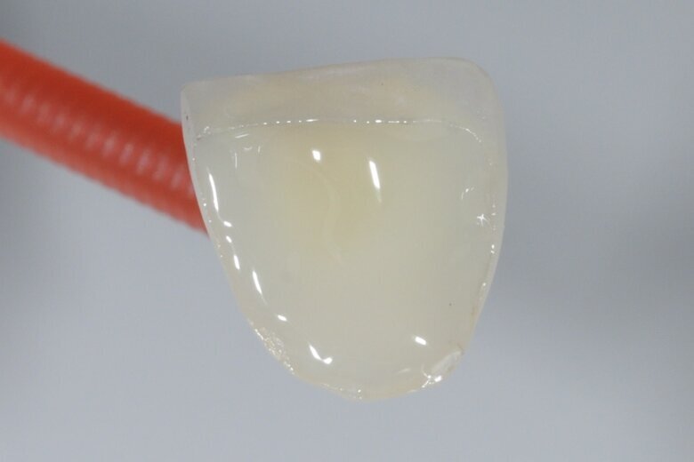 Fig. 20 PANAVIA V5 Paste spread over the veneer.