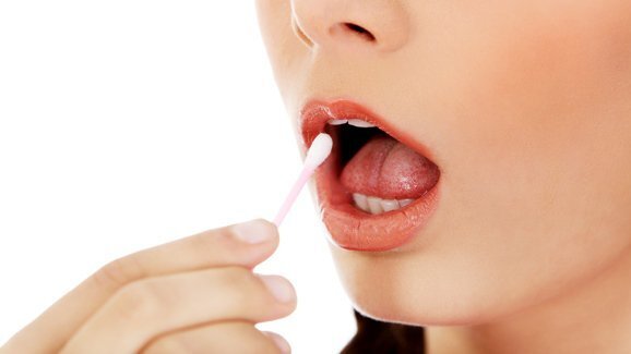 Presença de determinada bactéria bucal pode indicar o aumento de câncer de pâncreas