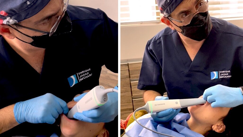 Lo que debes saber sobre los escáneres intraorales (2)