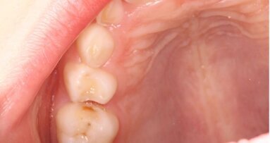 Preventie: een kwestie van volhouden