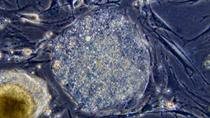 Pas de crise pour les banques… de cellules souches