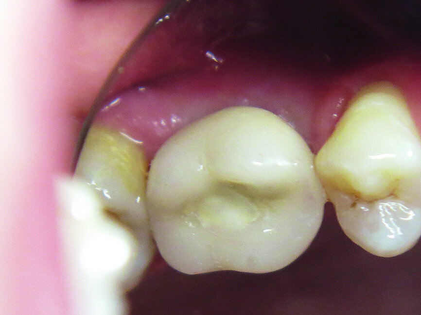 Fig. 21: Final situation.