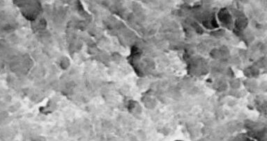 Usuwanie resztek z opracowanych kanałów korzeniowych