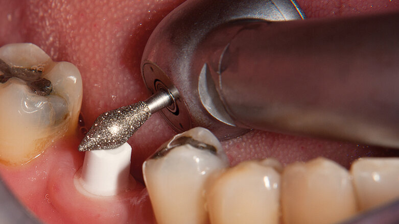 Fresas Z-Cut para repasar circonio