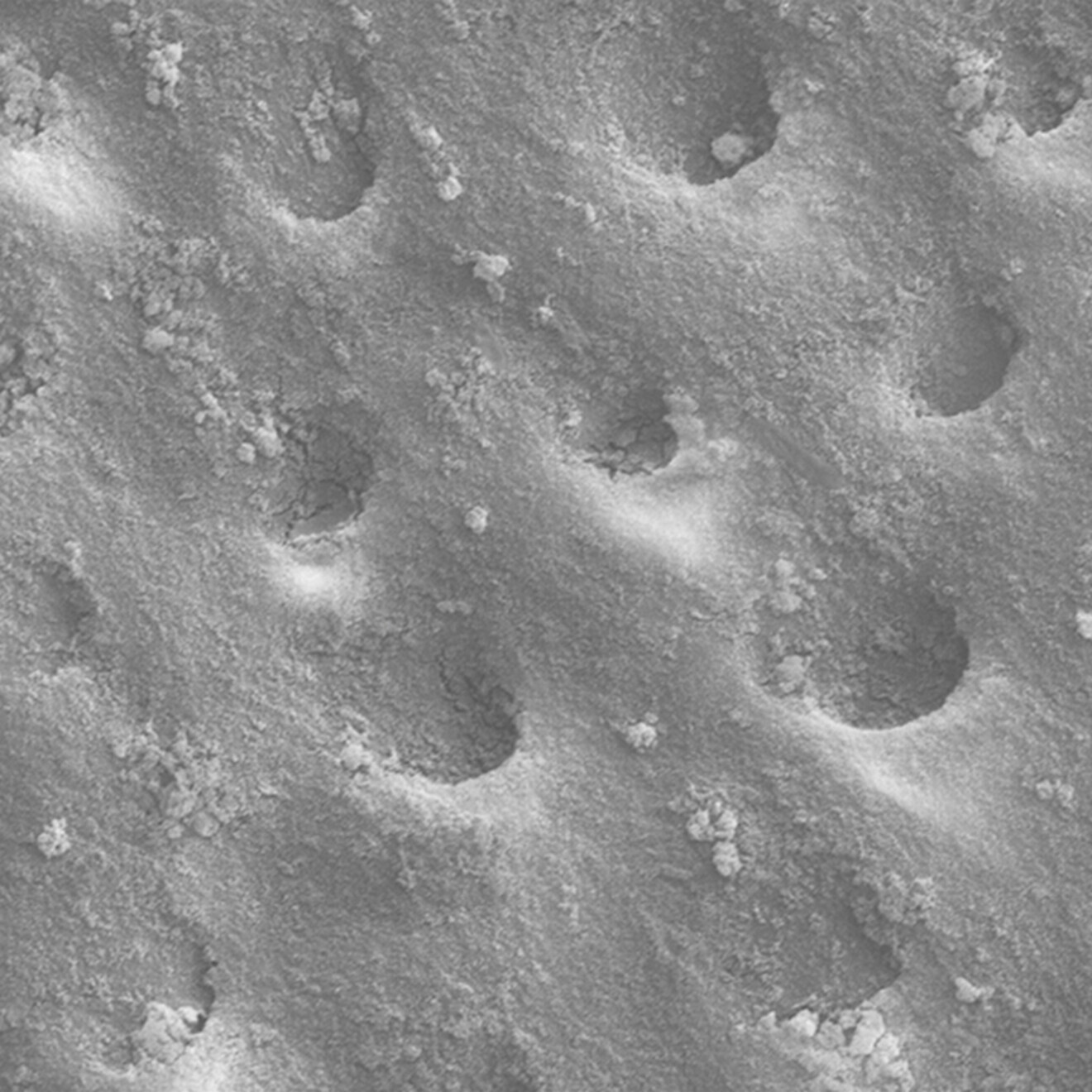 Fig. 1b: Dentin* nakon korištenja proizvoda Biosmalto. (Slika: Curasept)