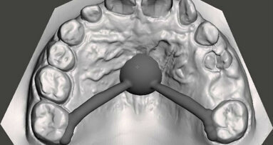 Ortodonzia intercettiva… oggi: viaggio dall’analogico al digitale