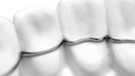 KFO-Apparaturen im digitalen Workflow: Sirona kooperiert mit CA DIGITAL