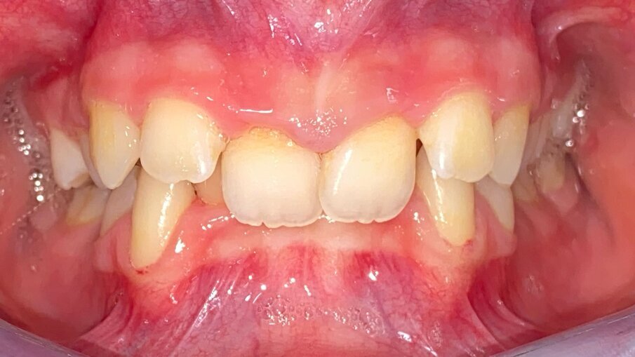 Fig. 5_Frontale pre-trattamento.