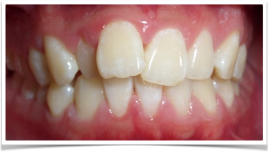 Fig. 19: Close-up view of the patient’s smile.