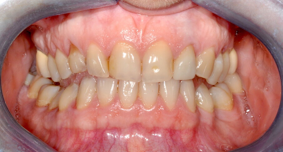 Fig. 1 - Fotografia frontale al T0.