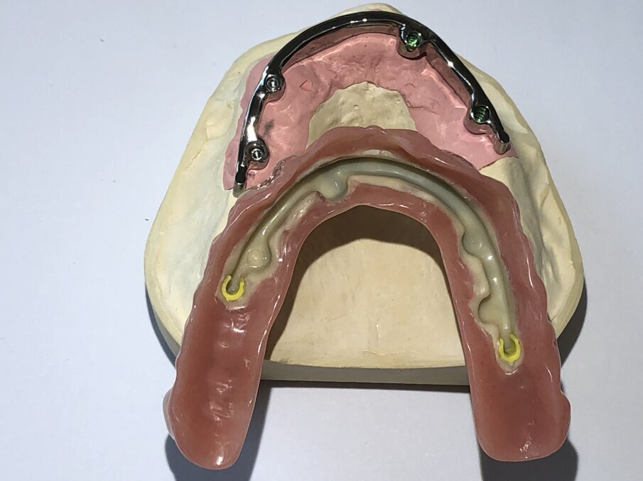 Afbeelding 12. Primair en secundair deel van gefreesde staaf.