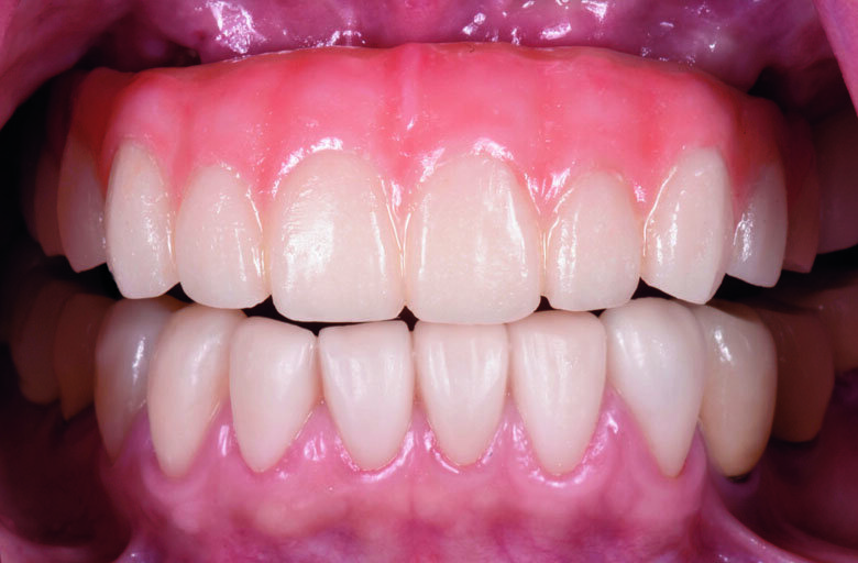 Fig. 24. Post-operative frontal view