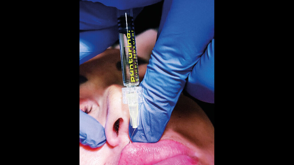 Un accesso semplificato alla medicina  estetica per gli odontoiatri: la formazione integrata di F.Aesthetic patrocinata SIMEO