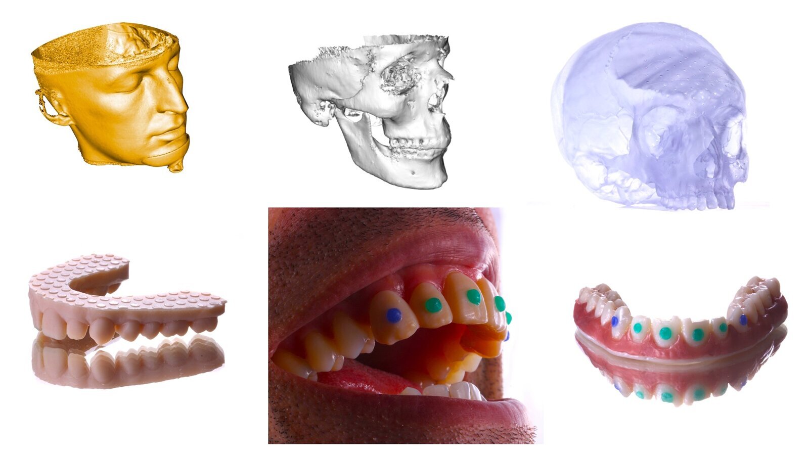 Reconstrucción de una dentadura maya – Newsletter DT Latinoamérica No, 3. 2021