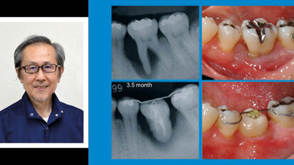 Световният експерт по автотрансплантация д-р Мицухиро Тцукибоши идва за първи път в България