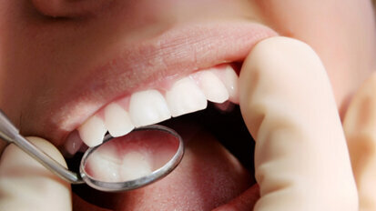 Η επίδραση της τάσης κυκλικής κόπωσης-βιοδιάβρωσης στις μη τερηδονικές αυχενικές  βλάβες