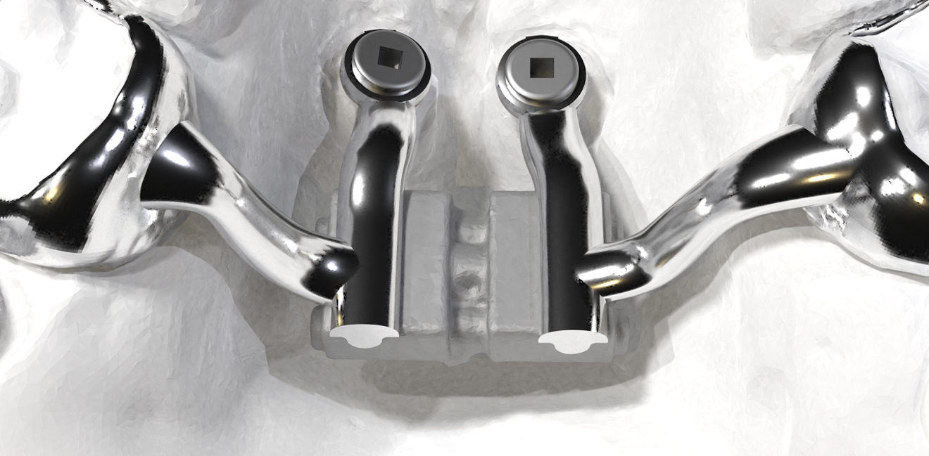 CAD/CAM design and metal printing of a mini-screw-anchored expansion (MARPE).